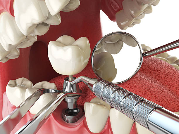 Best Urgent Tooth Repair  in Church Hill, PA